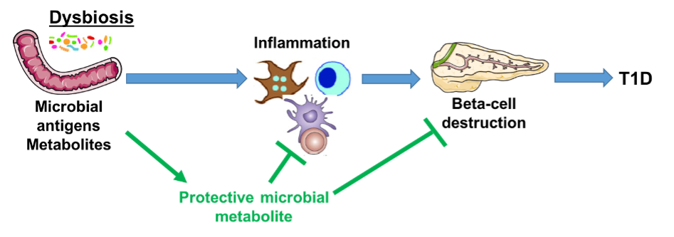 Gut microbes can help fight type 1 diabetes