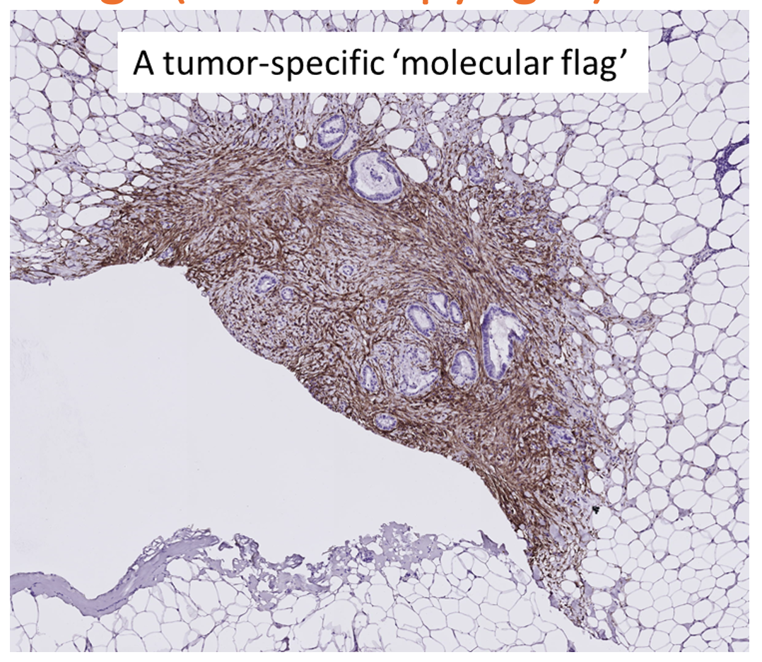 A tumor specific molecular flag