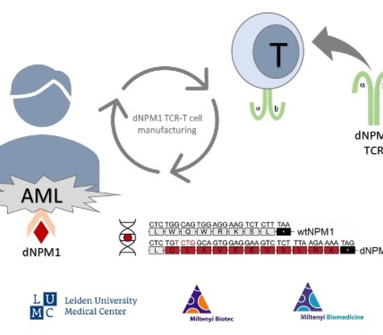 Immunotherapy targeting mutant nucleophosmin-1 on acute myeloid leukemia