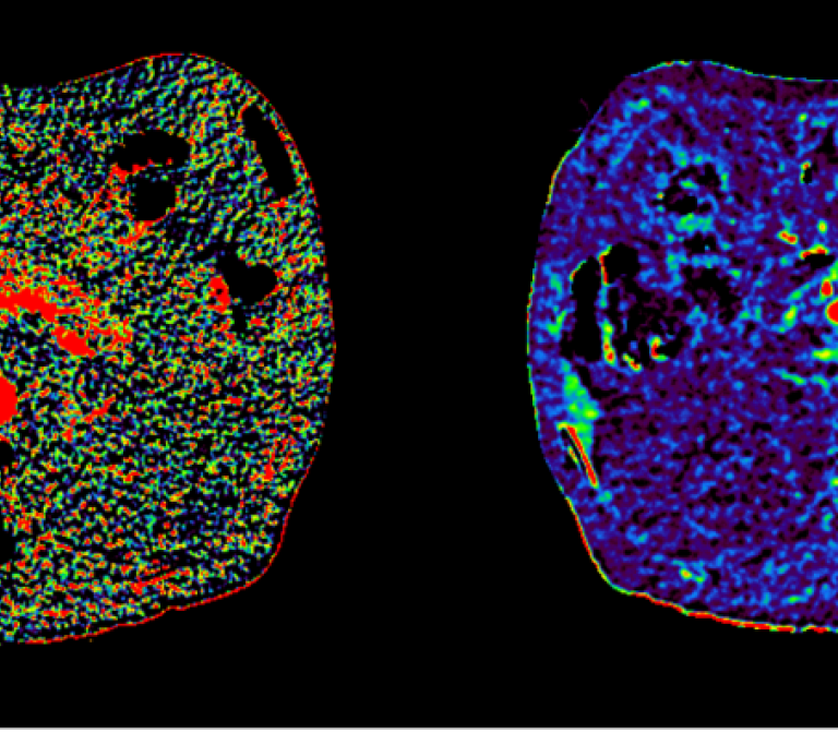 Artificial intelligence for imaging how the body works