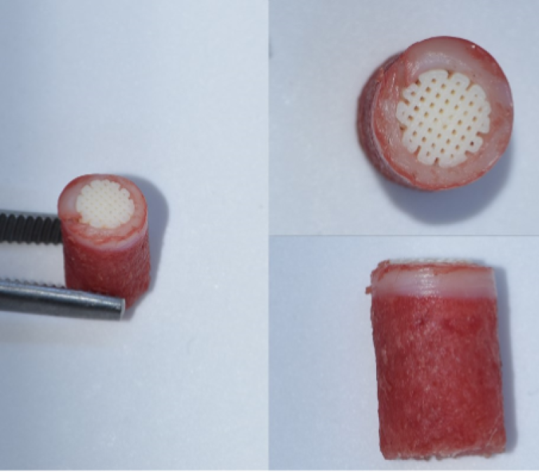 The evaluation of gradient scaffolds for osteochondral regeneration