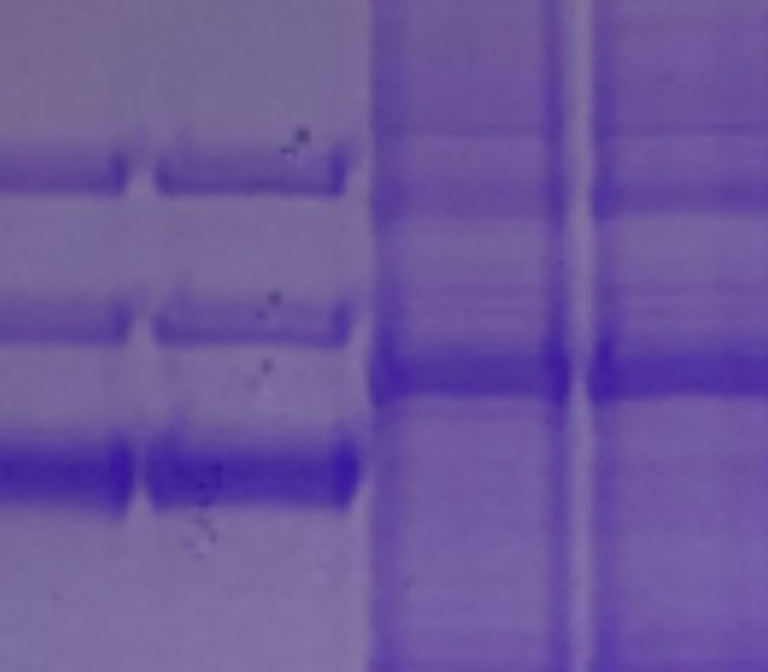 Gene therapy for liver disorder