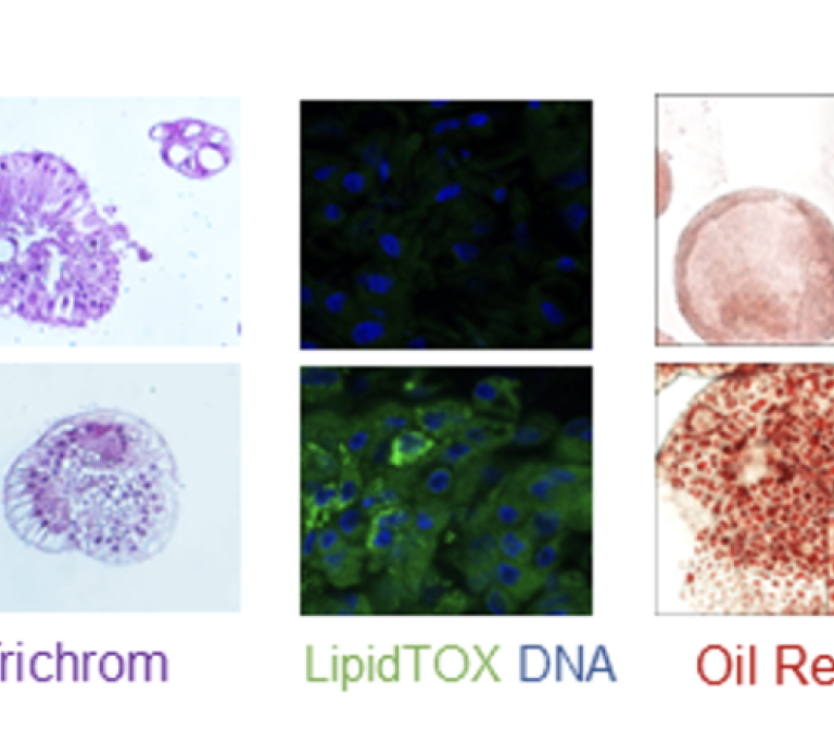 Mini liver-organs to model fatty liver diseases and identify therapeutics.