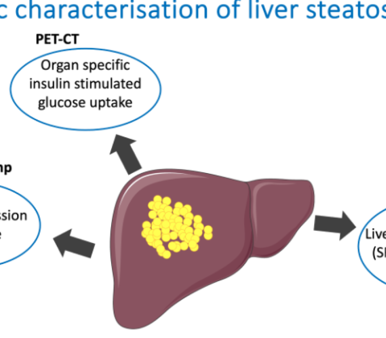 Different views on insulin sensitivity of the liver